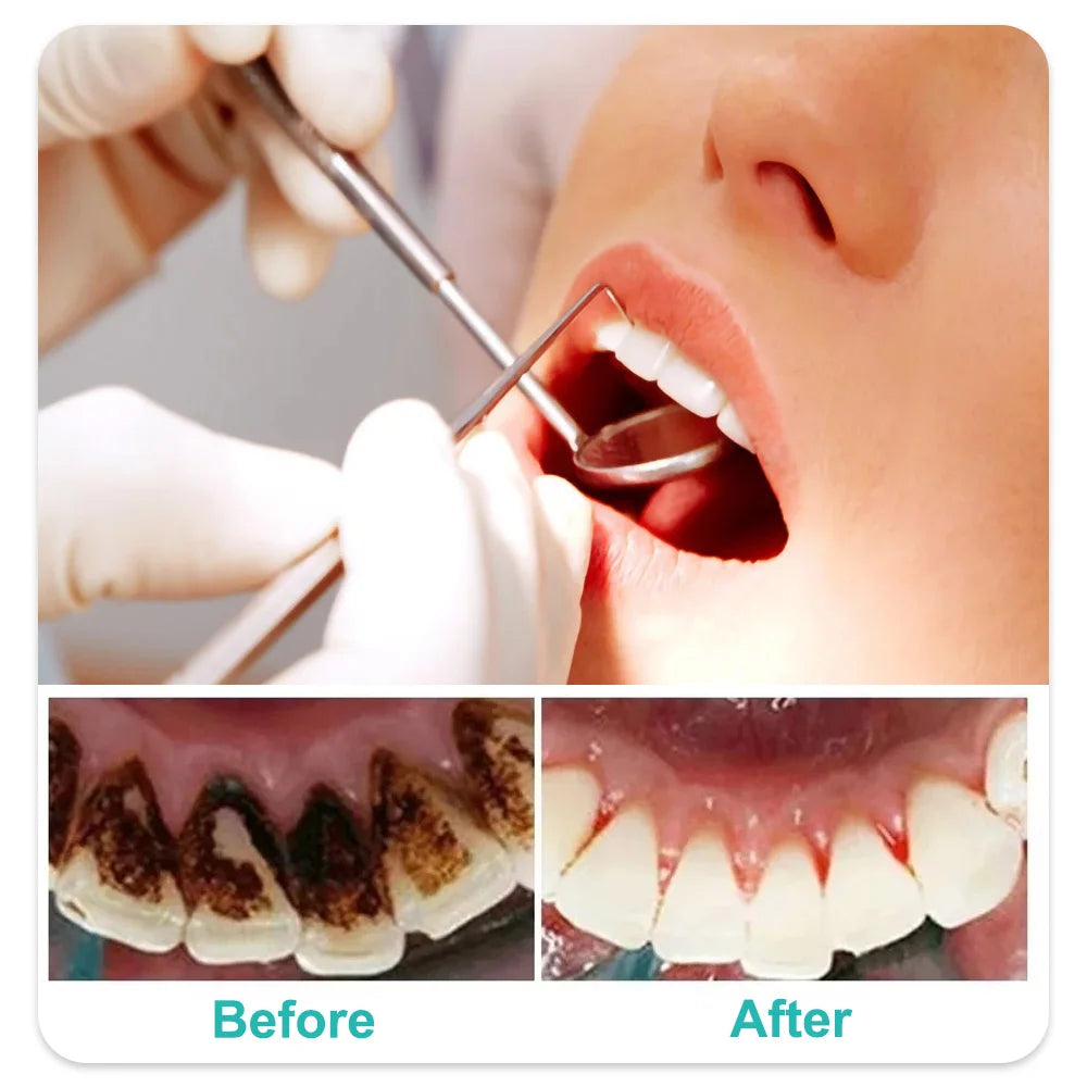 Sa55716a4facd4e198d708807497fb014Q